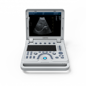 Φορητός Υπέρηχος CONTEC CMS600P2 Plus | Convex Probe 3.5MHz ή Linear Probe 7.5MHz