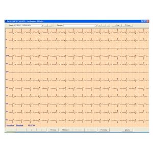 Λογισμικό Καρδιογράφων Aspel CardioTEKA