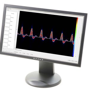 Dopplex® Vascular Reporter Software Λογισμικό Αγγειολογικών Doppler Huntleigh